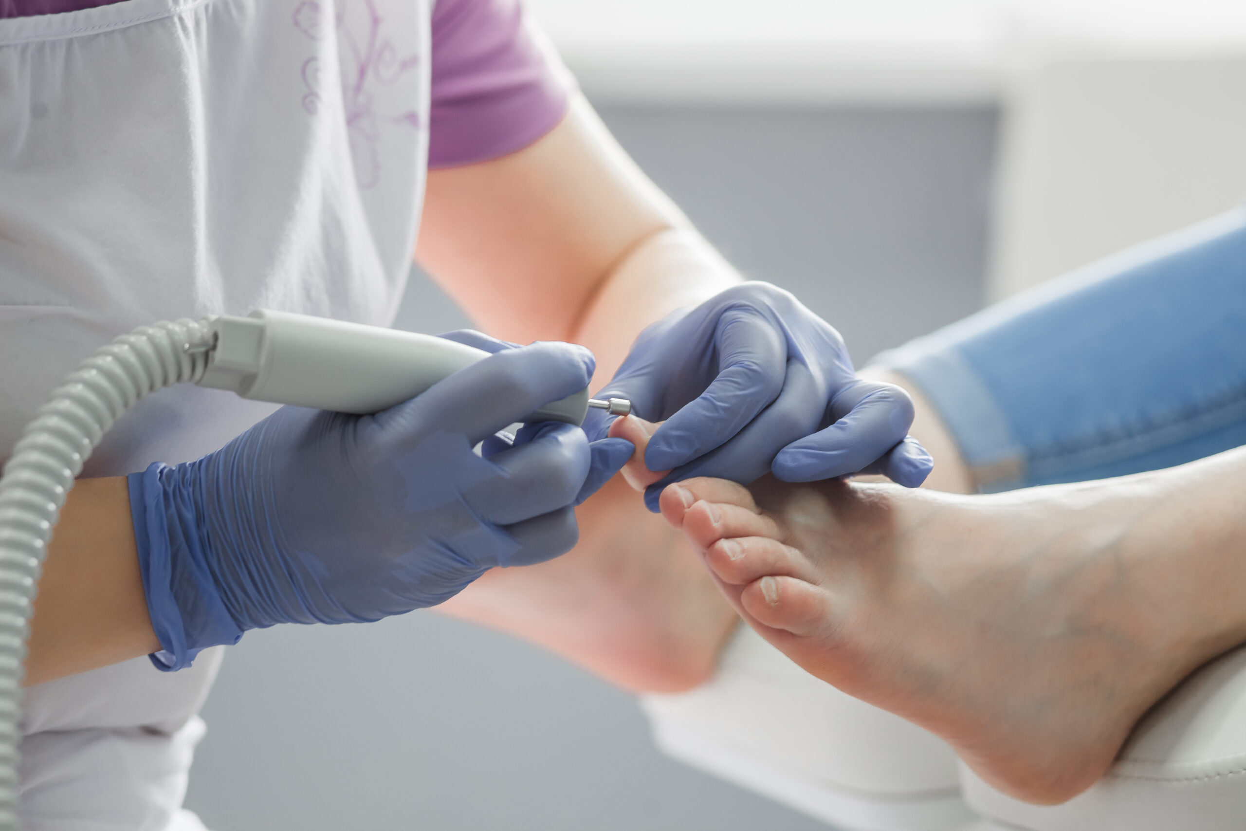 Nail Care & Ingrown Toenail Treatment